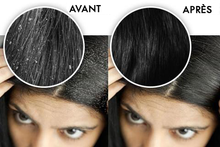 Charger l'image dans la galerie, Sup'Hair Brosse®